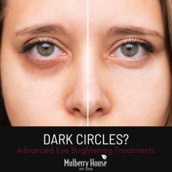 How To Treat Under-Eye Dark Circles