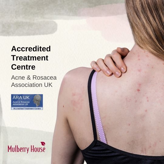 Antibiotics for Acne - Comprehensive Guide