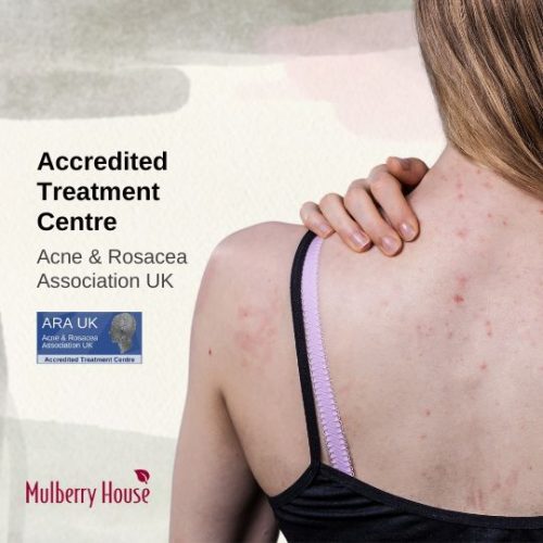 The Itch Factor: Managing Itchy Acne