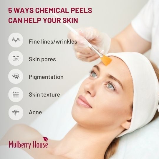 5 Ways Chemical Peels Can Help Skin